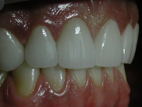 То же - вид сбоку