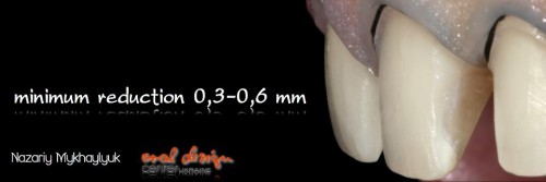 А вот это - Hi-End в стоматологическом фото в моем понимании