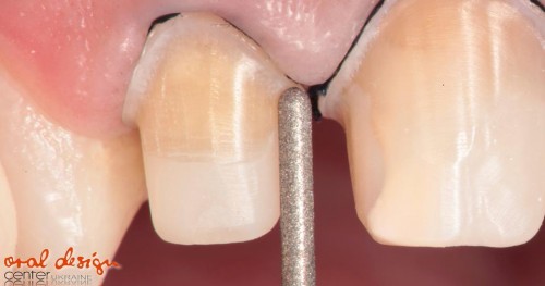 вот такие макро я бы считал крайне удачными...